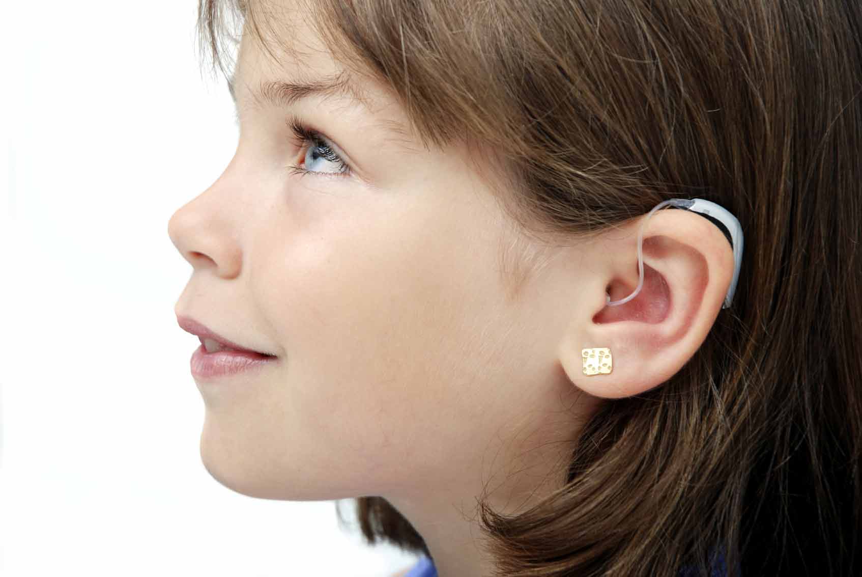 La microtia es una anomalía en el pabellón auricular